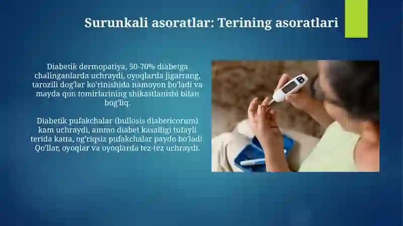 Qandli diabetning surunkali asoratlari 3