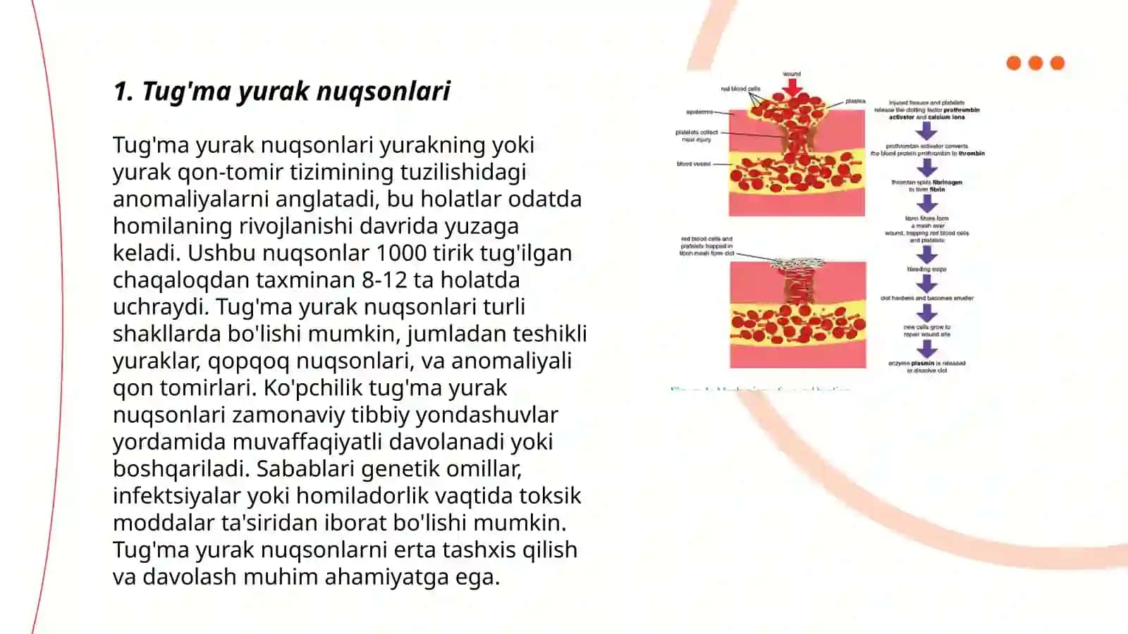 Tug'ma yurak nuqsonlari 3