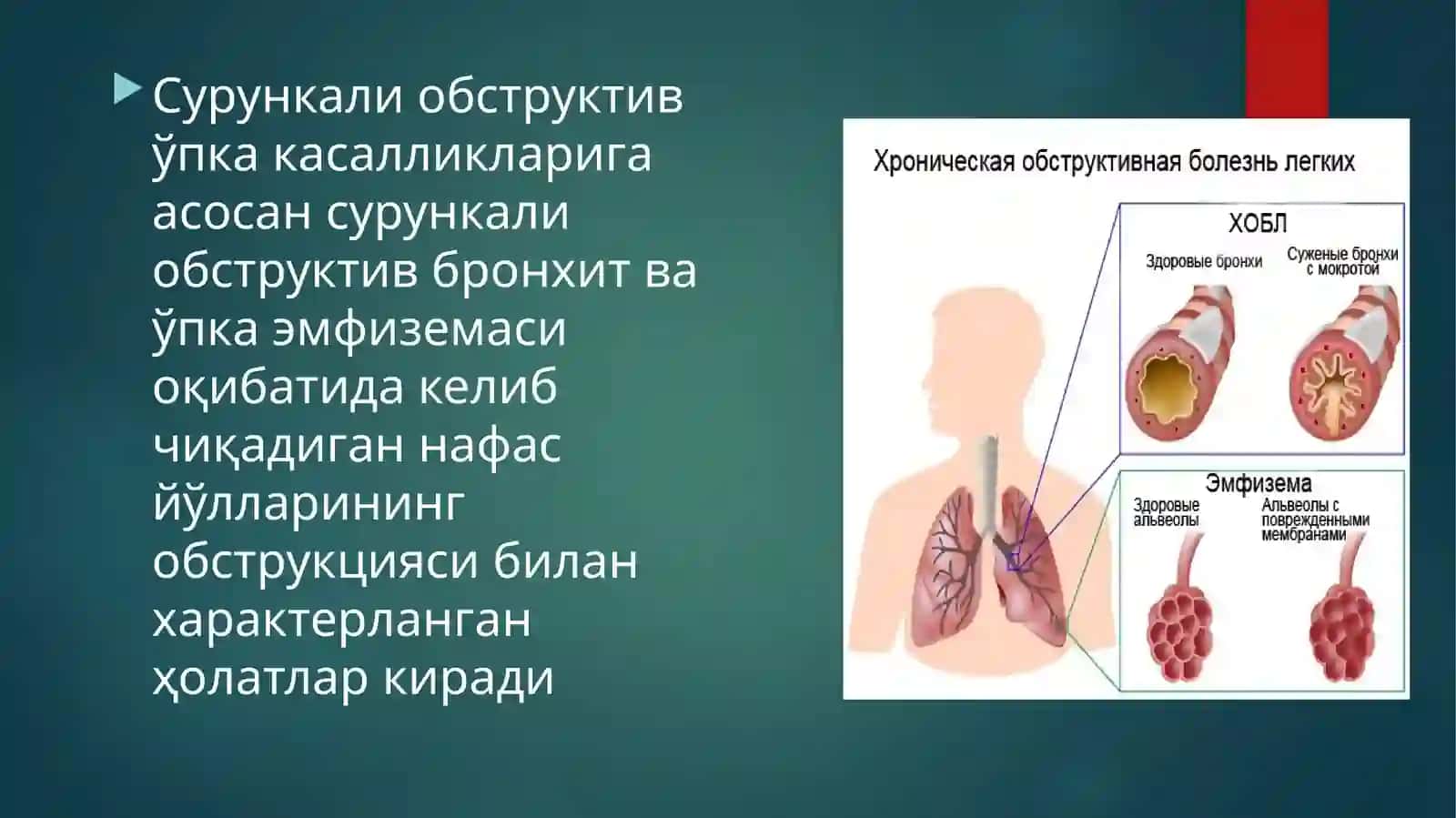 Сурункали обструктив ўпка кaсалликлари 3