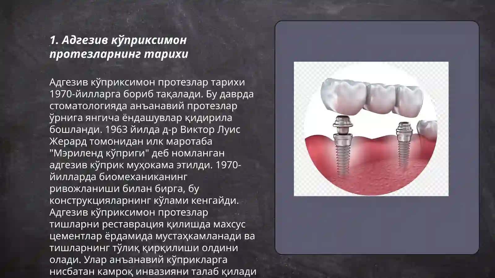 Stomatologiyada Adgeziv koʻpriksimon protezlar 3