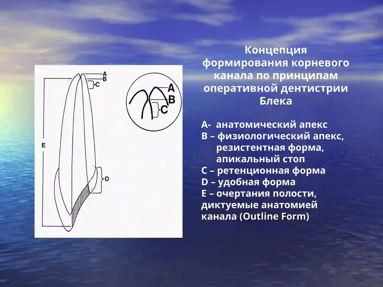 Принципы препарирования полости зуба 3