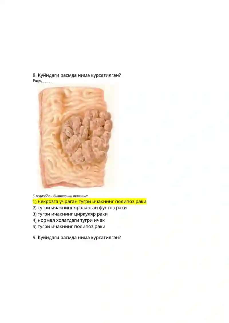 Чопингрен 3