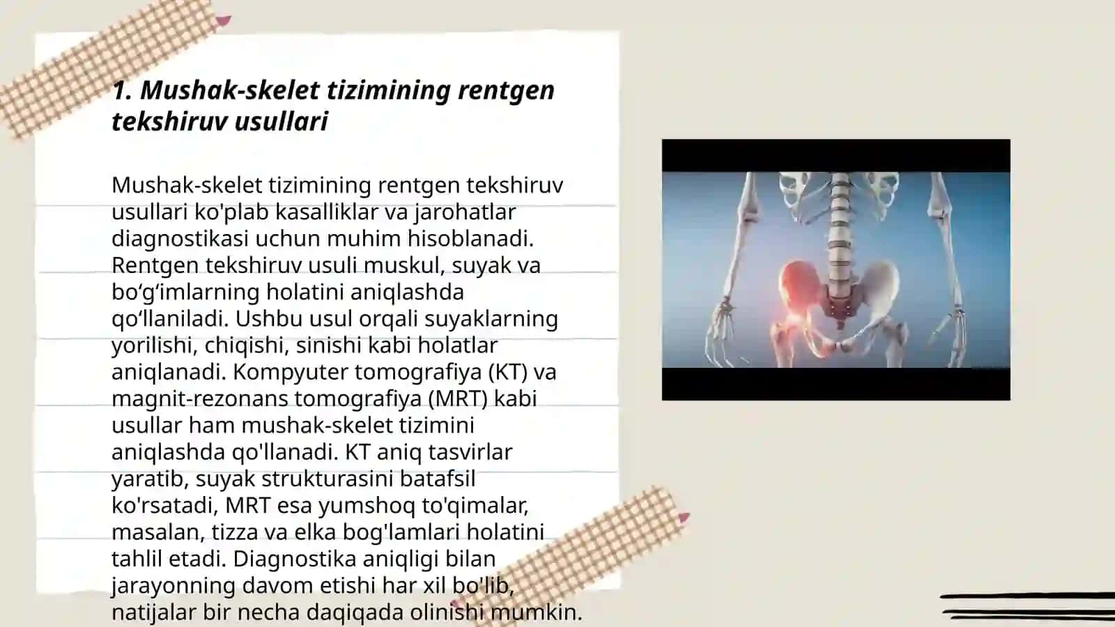 Mushak- skelet tizimining kasalliklarini tashxislash usullari 3