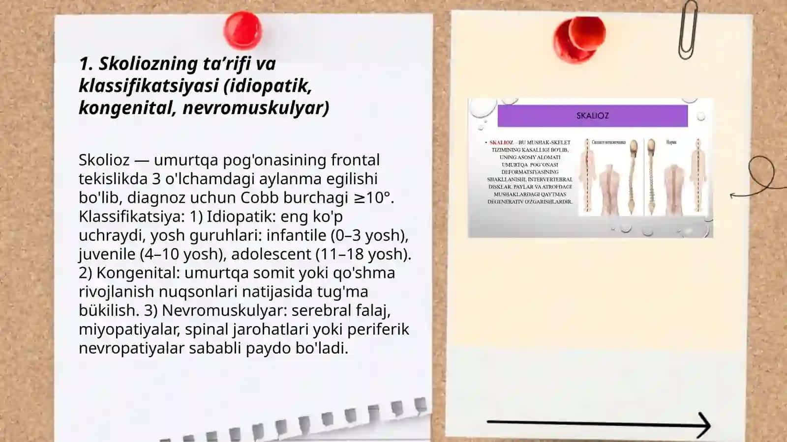 Qad-qomat nuqsonlari Skolioz kassaligi 3