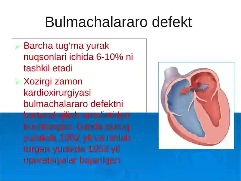 Tug‘mayurak nuqsonlari 3