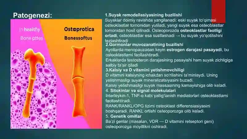 Osteoporoz 3