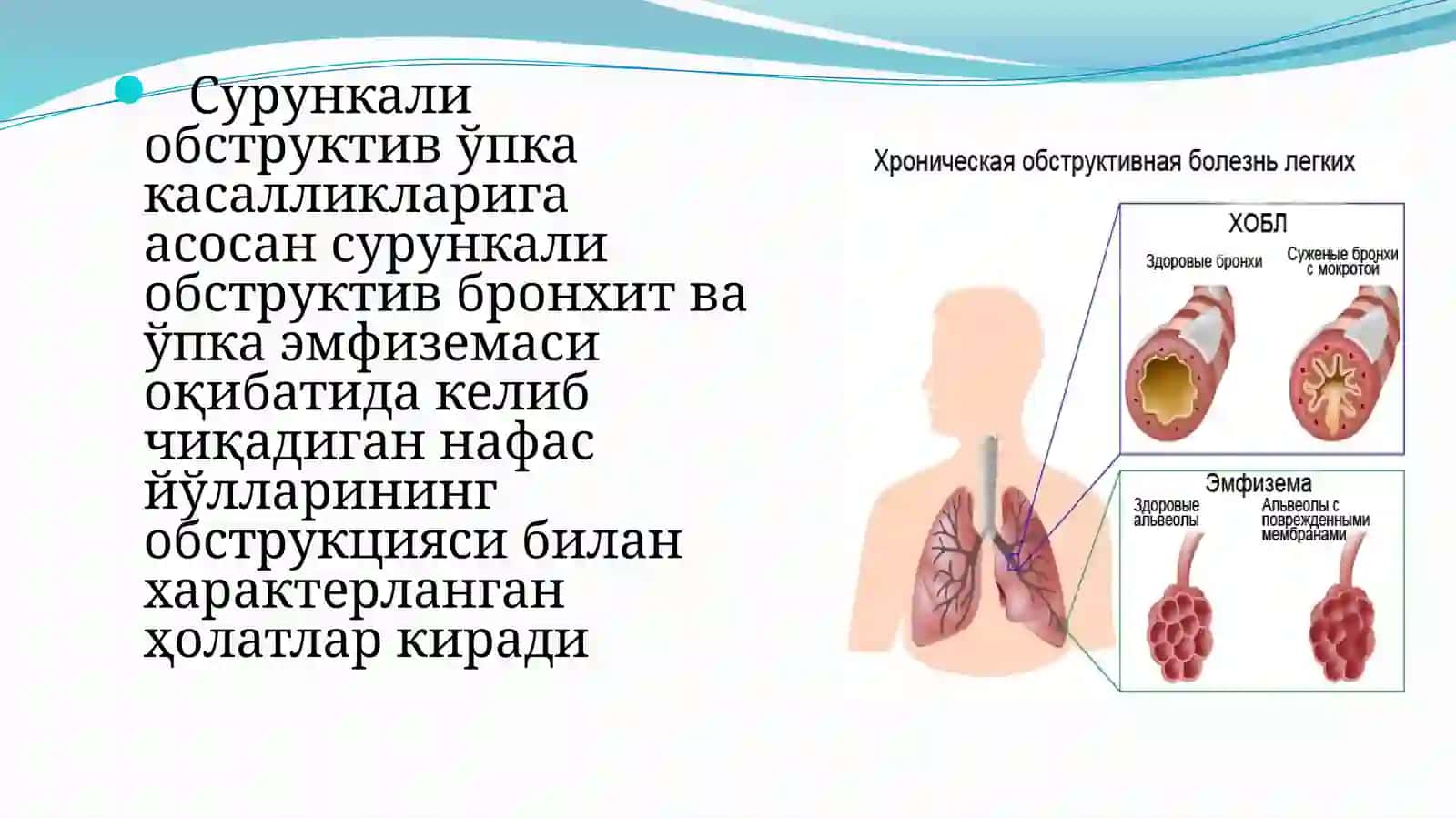 Сурункали обструктив ўпка касалликлари 3