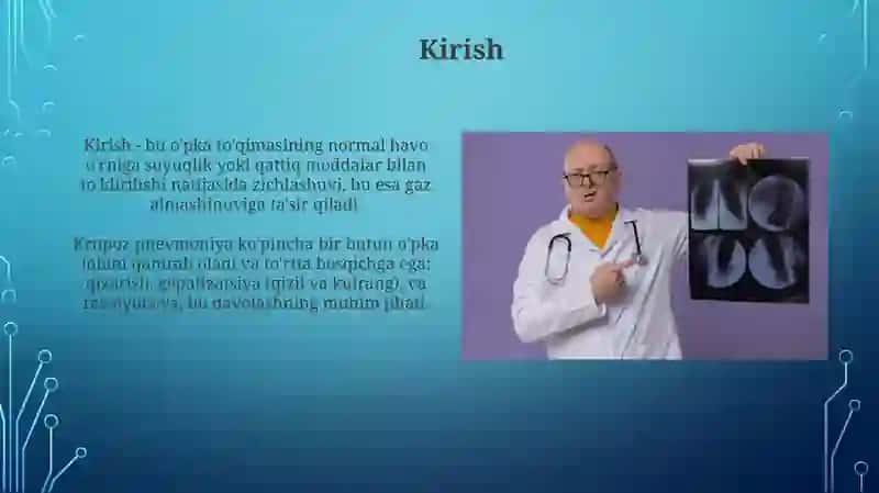 O'pka to'qimasini zichlashish sindromi 3