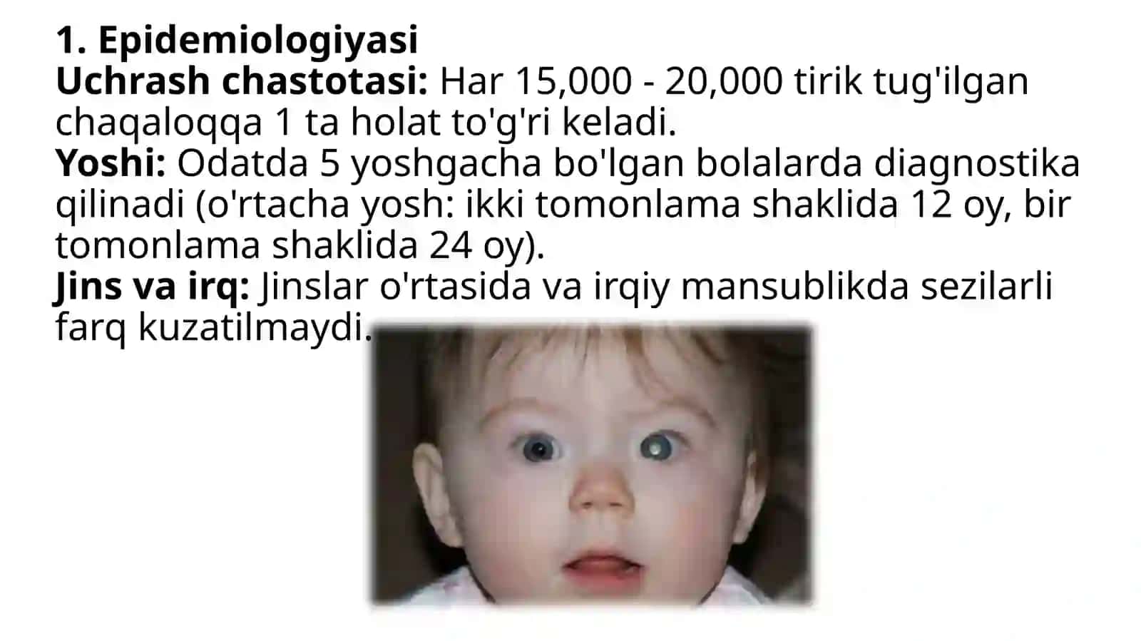 Retinoblastoma 3