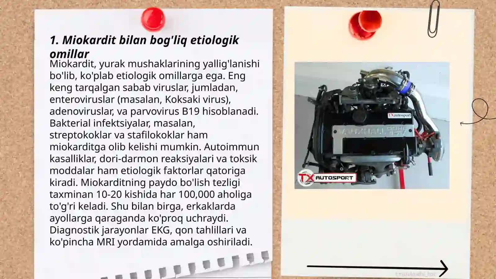 Miokardit, perikarditlar. Etiologiya, patogenezi 3