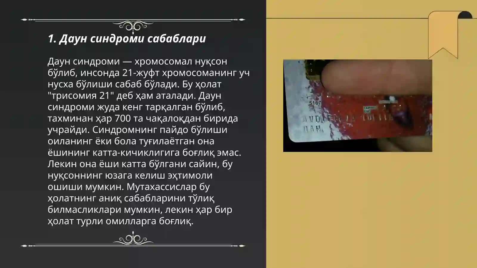 Даун касаллиги ҳақида малумот 3