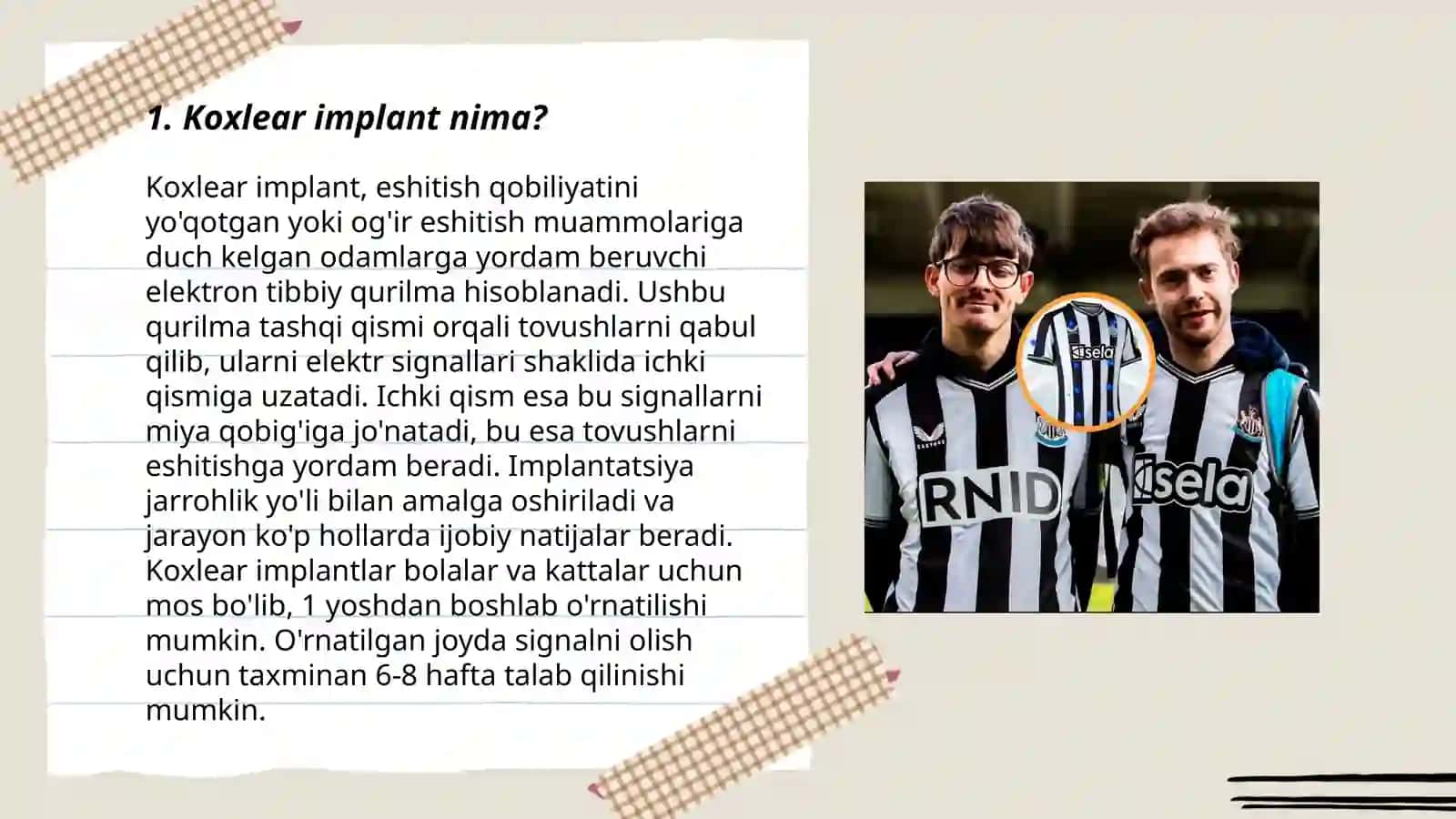 KOXLEAR IMPLANTLI ESHITISHDA NUQSONI BOLGAN BOLALAR 3
