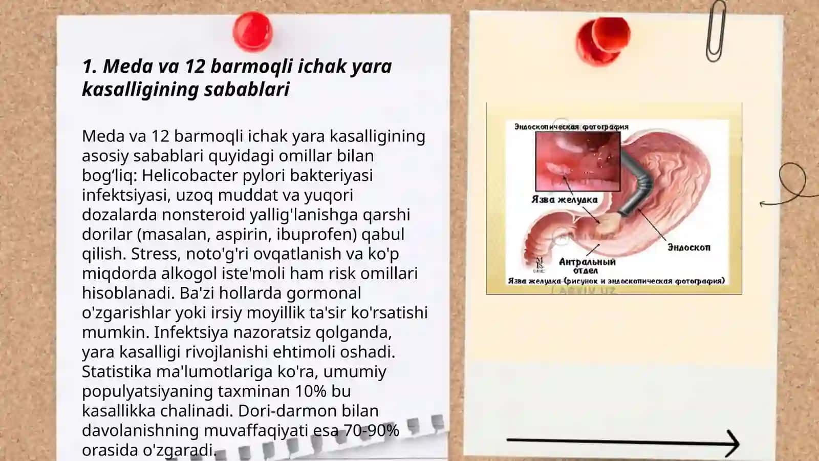 Meda va 12 barmoqli ichak yara kasalligi 3