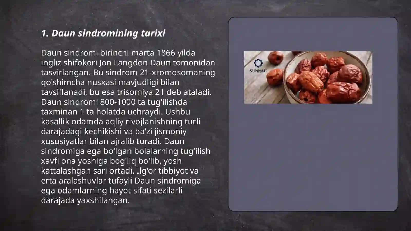 Daun sindromining tarixi 3