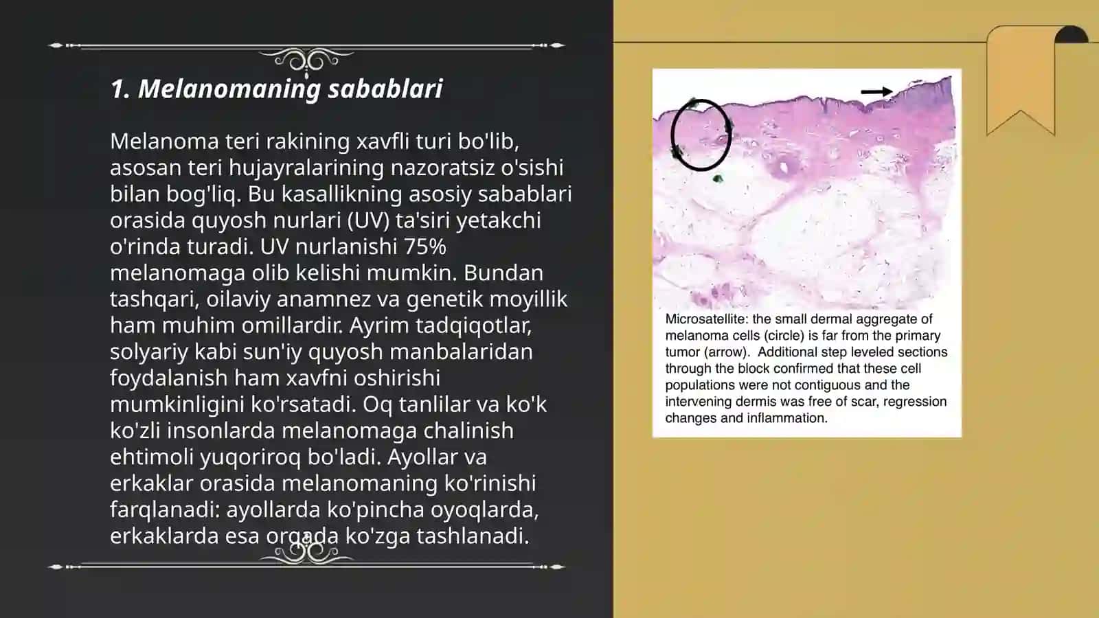 Teri O'smalari Melanoma 3