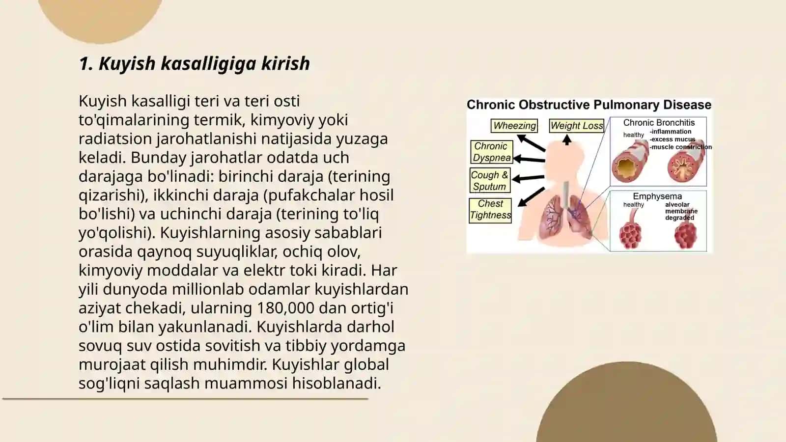 Kuyish kasaligi 3