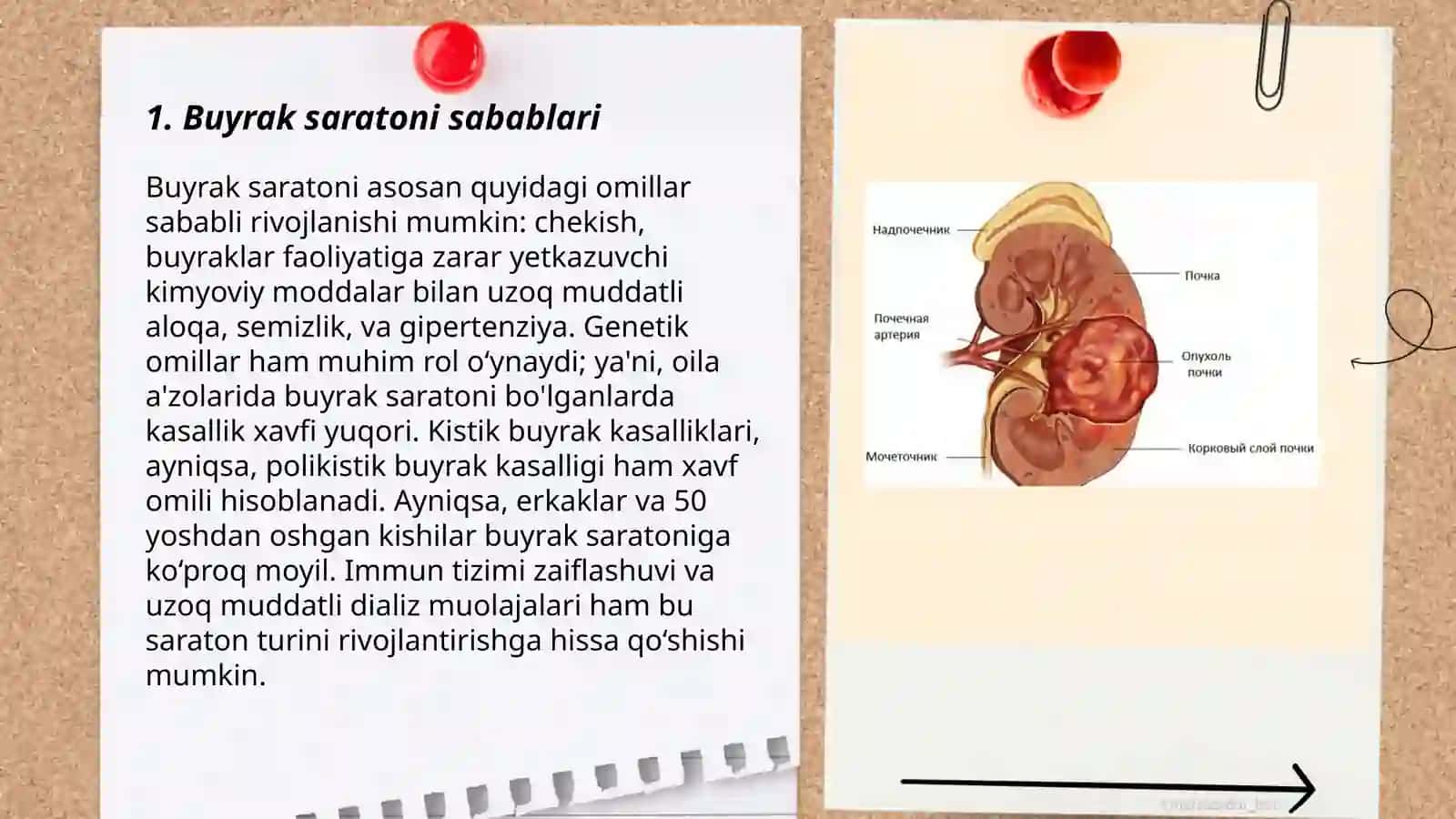 Buyrak saratoni 3