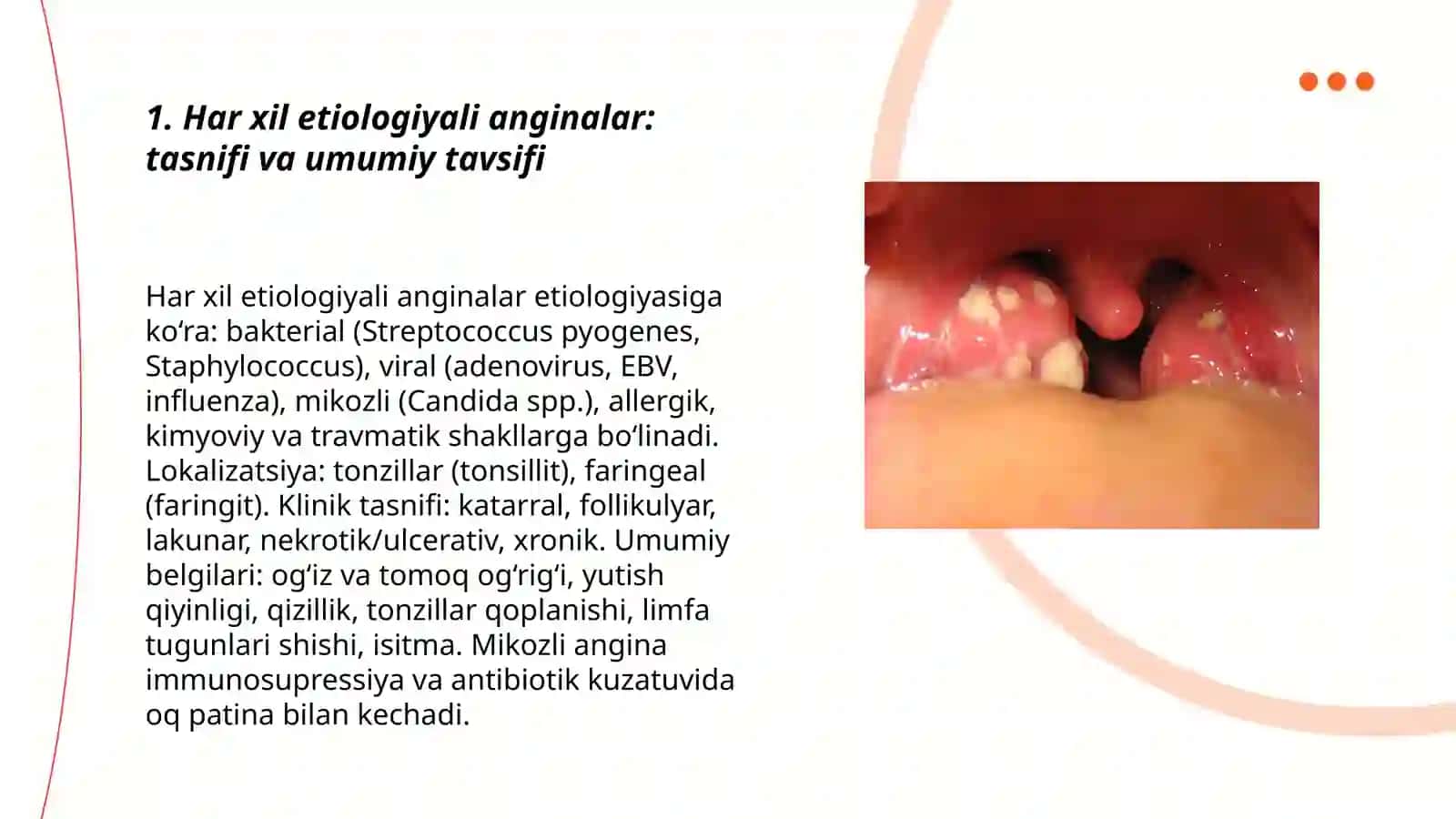 Har xil etiologiyali anginalar 3