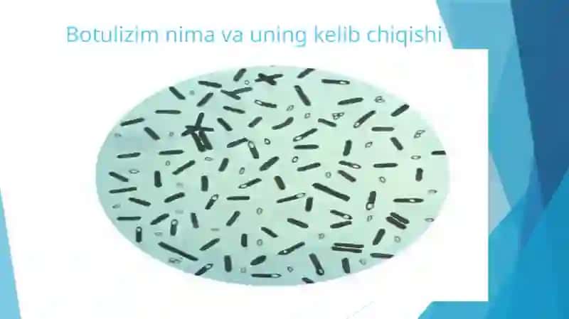 Botulizm qo‘zg‘atuvchisi va ularni amaliyotdagi ahamiyati, diagnostikasi. 3