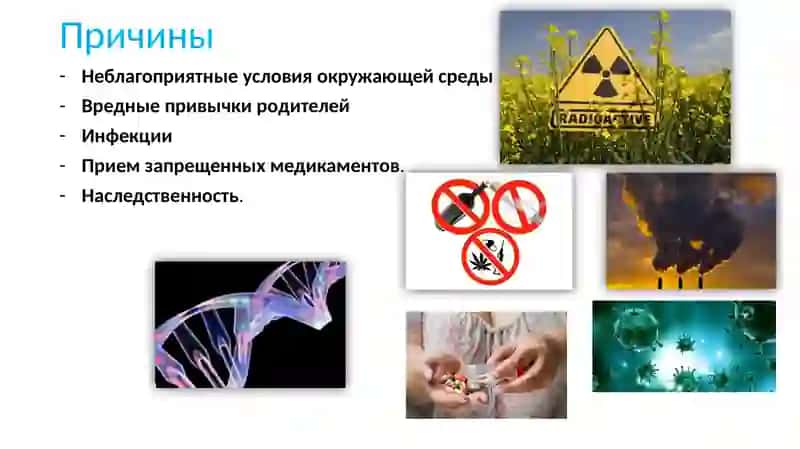 Аномалии развития селезенки 3