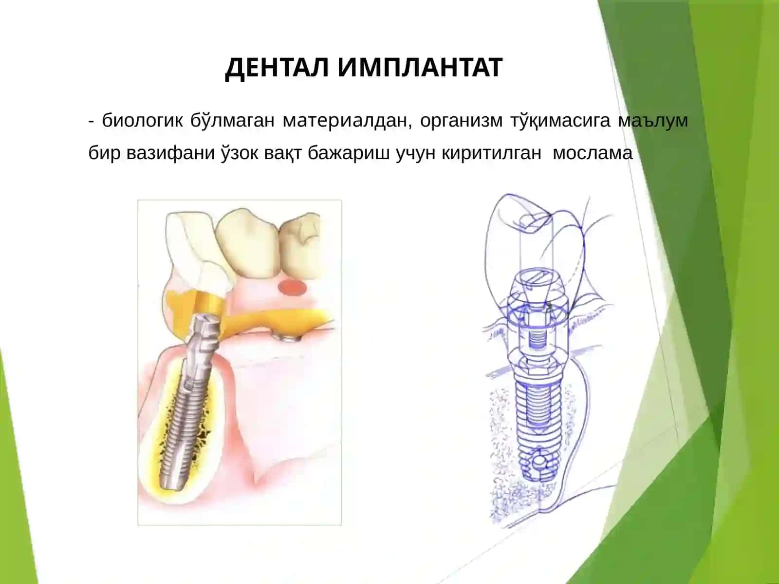 Suyak ichi implantlari 3