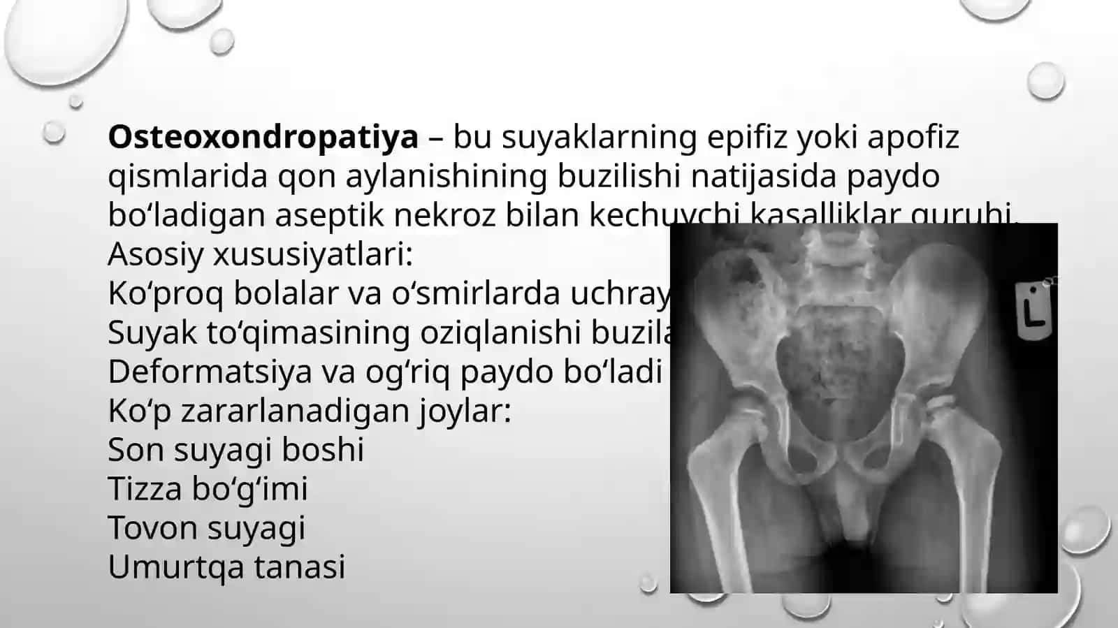 Osteoxondropatiyalar. Skolioz. 3