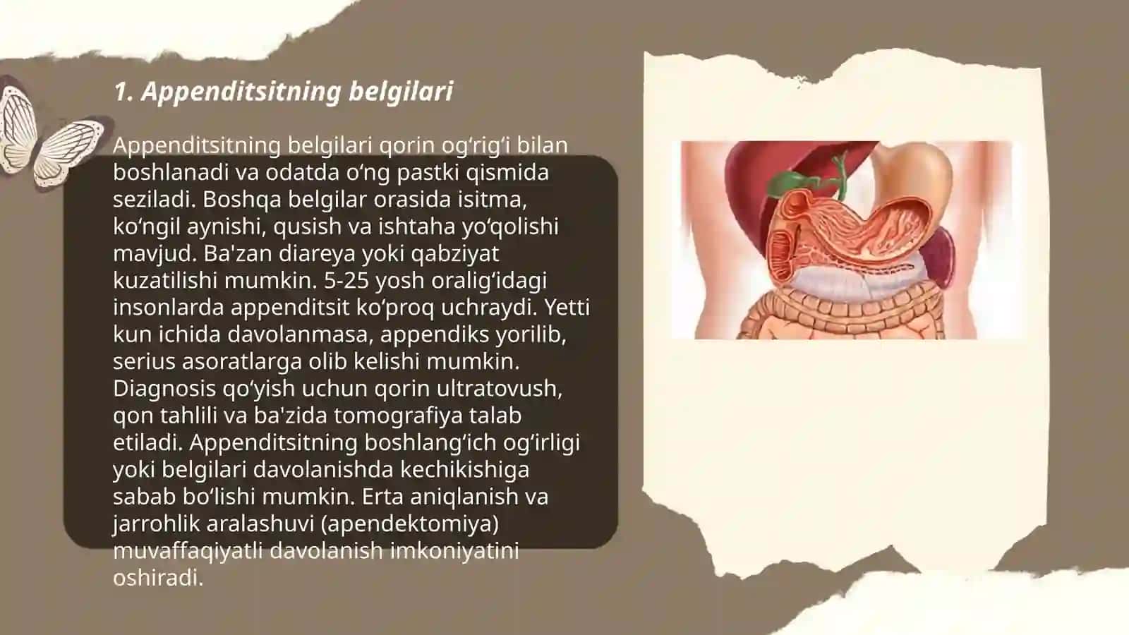 Appenditsit kasalligi 3