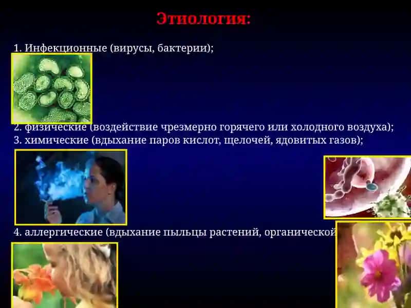 Острый бронхит 3