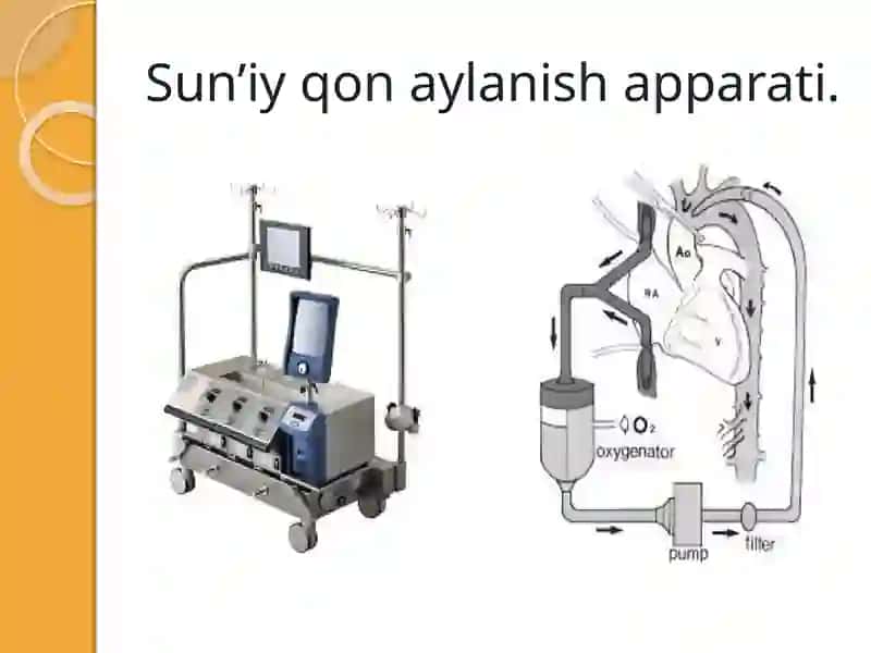 Sun’iyqon aylanishapparati 3