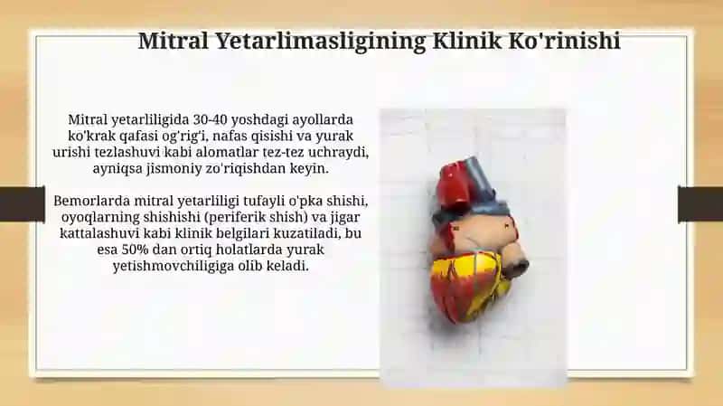 Mitral Qopqoq Kasalligi 3