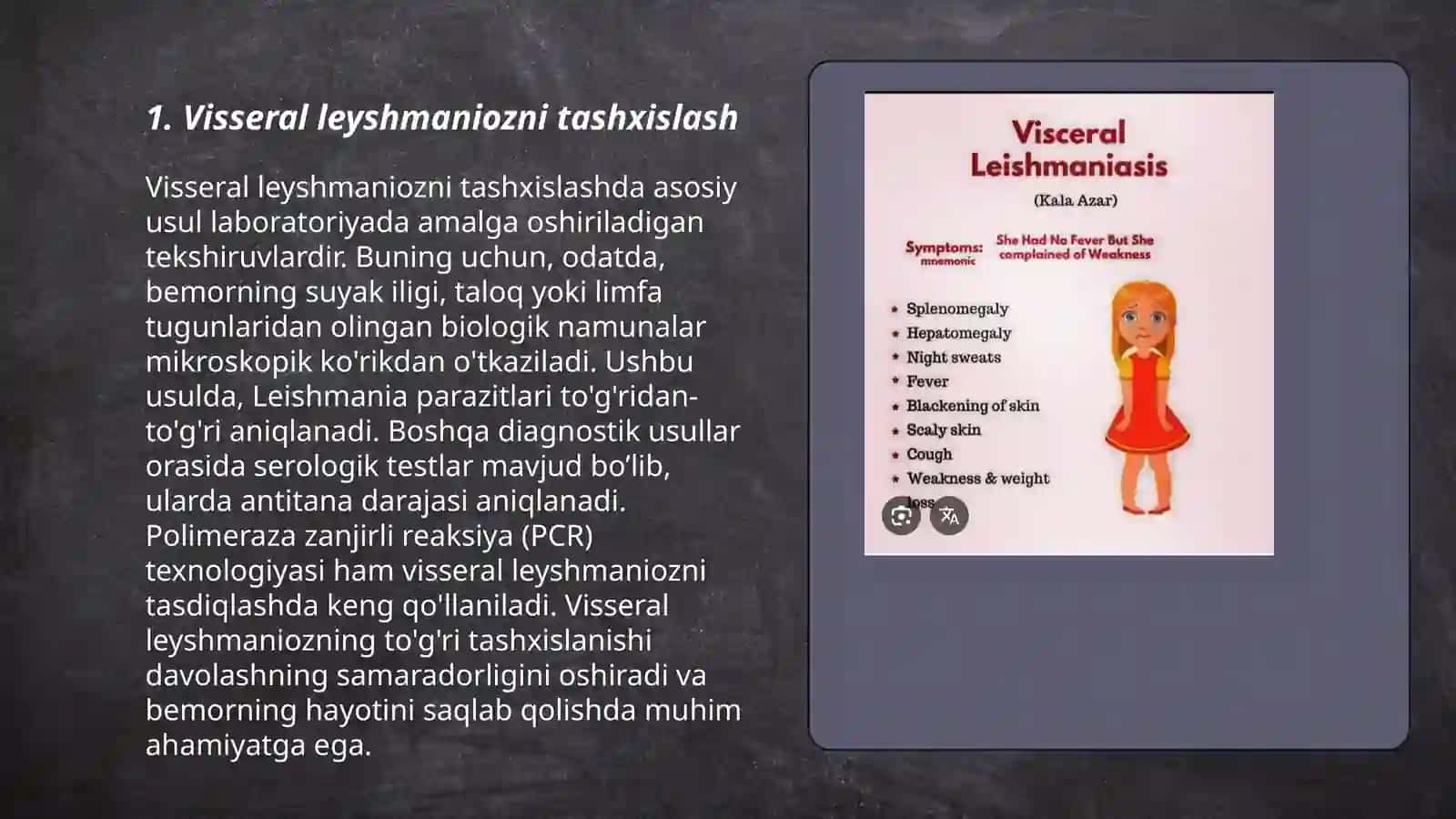 Visseral leyshmanioz 3