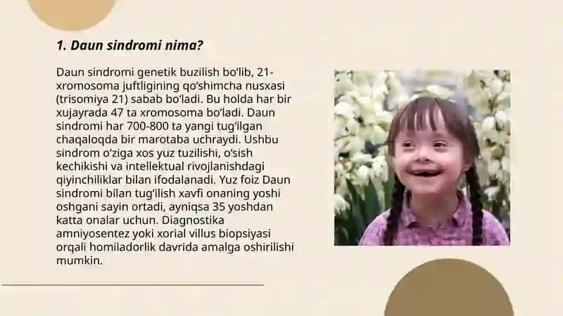 Daun sindromi 3