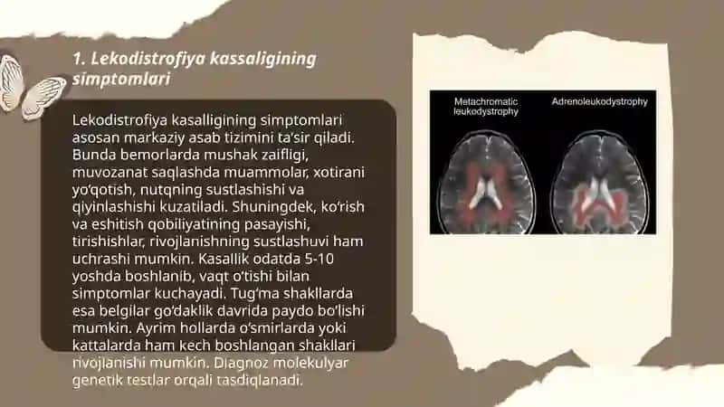 Lekodistrofiya kassaligi 3