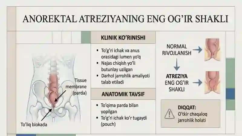 Toʻgʻri ichak va anal teshik atreziyalari 3