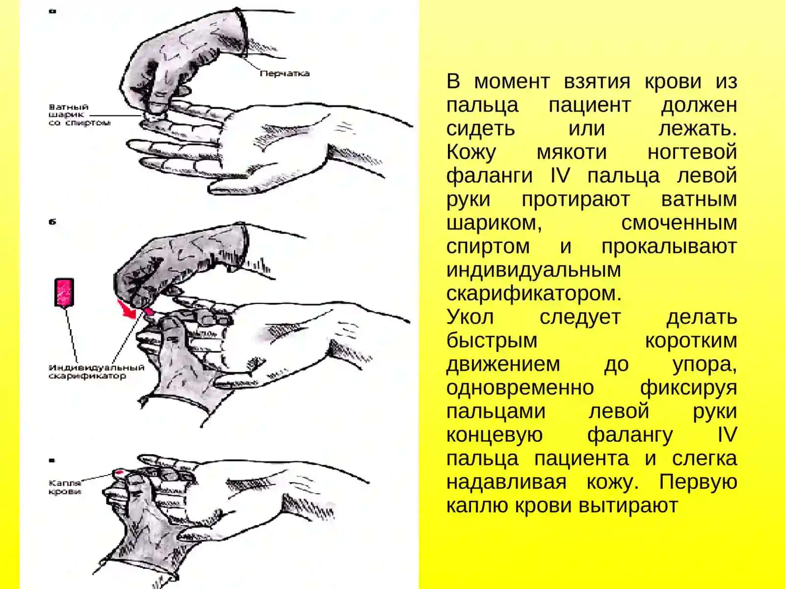 Общий анализ крови 3