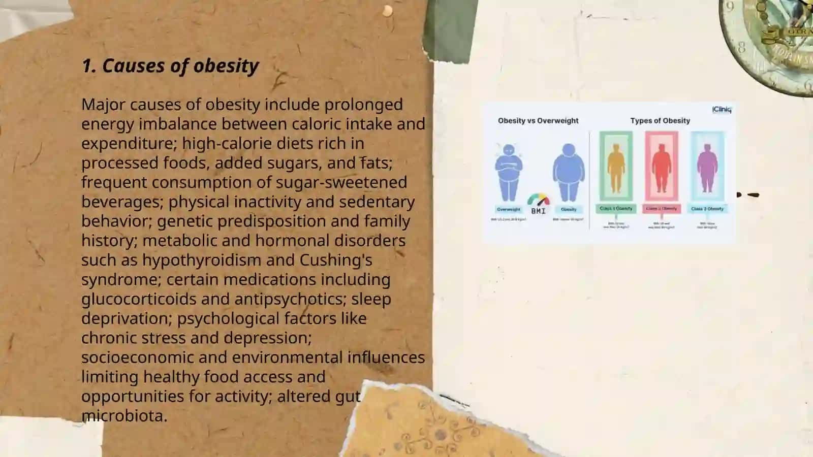 Obesity 3