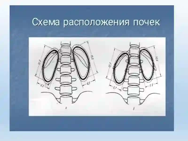 Сийдик айирув тизими касалликларининг комплекс нур диагностикаси 3