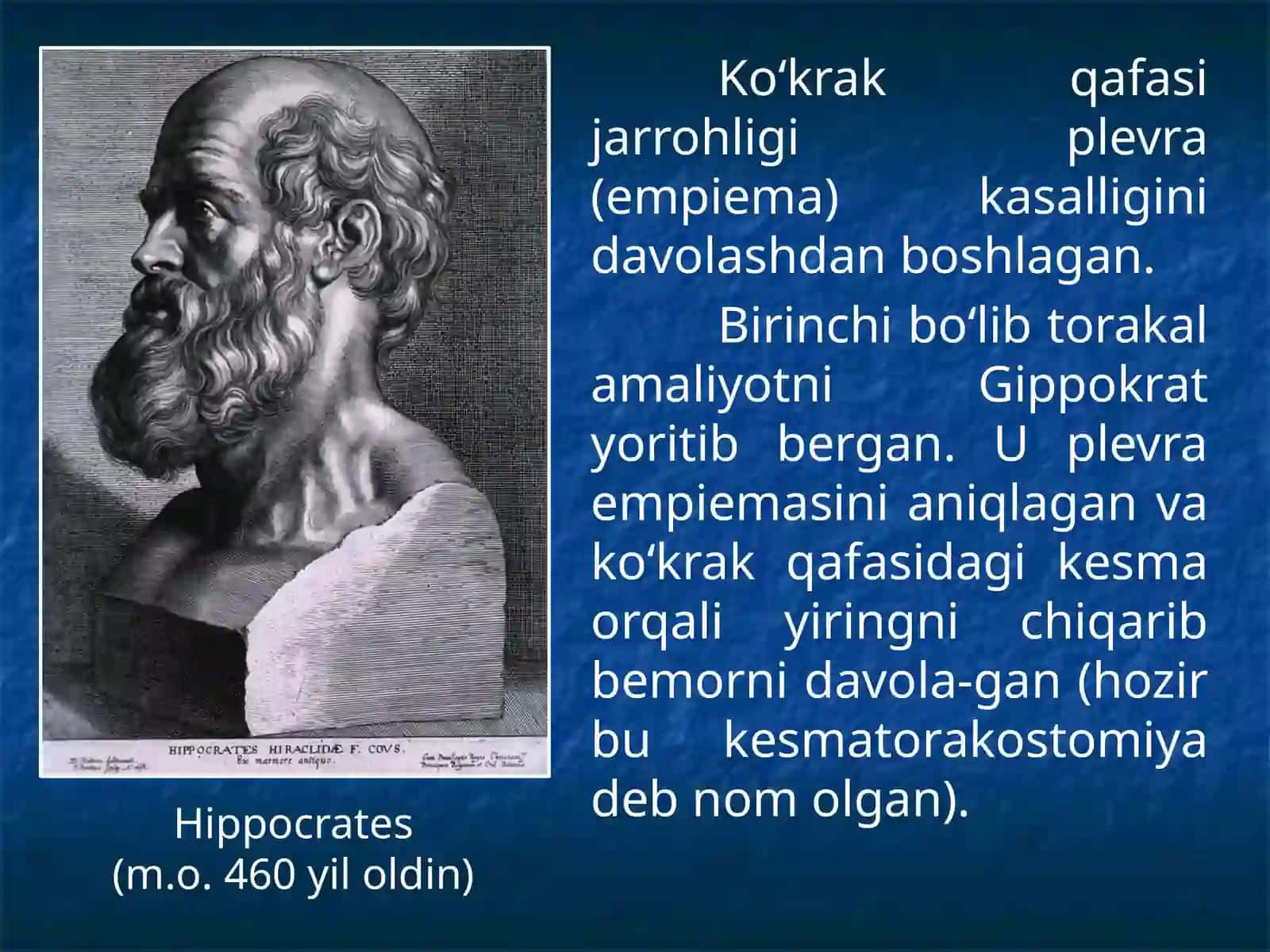 Plevra kasalliklari 3