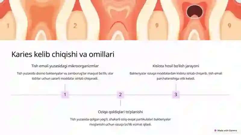 Karies kelib chiqish nazaryasi 3