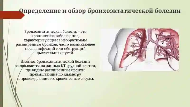 Бронхоэктатическая болезнь 3