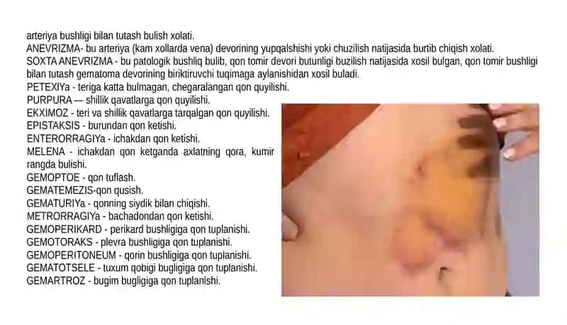 Qon Ketusish 3