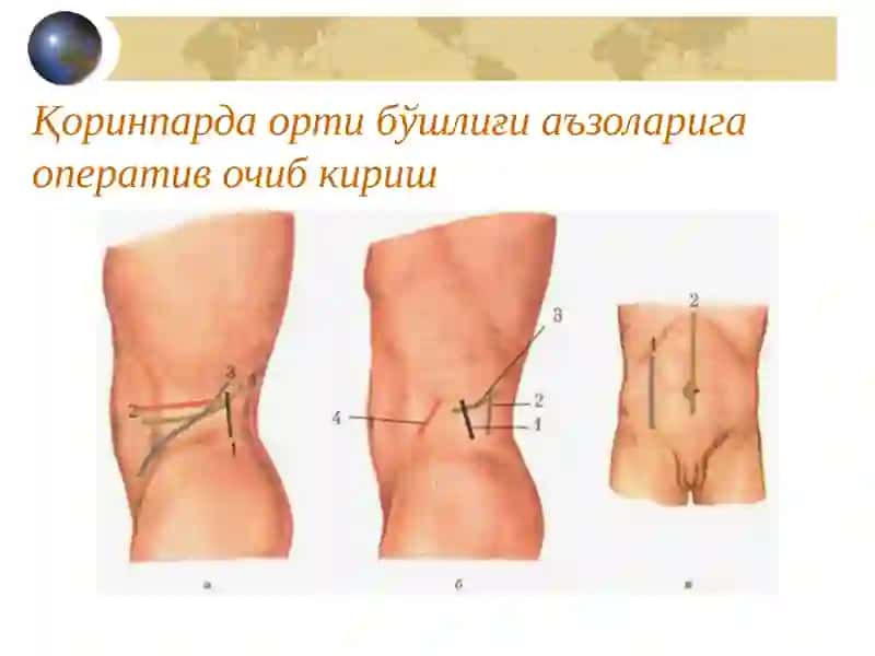 Қоринпарда орти бўшлиғи клиник анатомияси 3