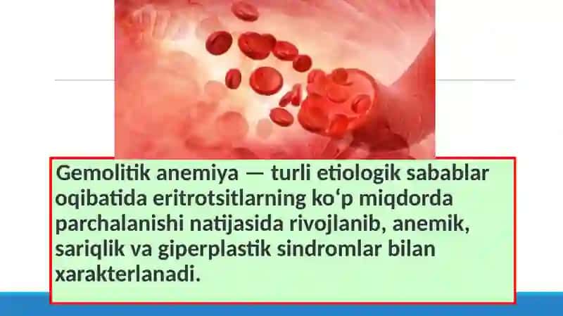 Gemolitik anemiya 3