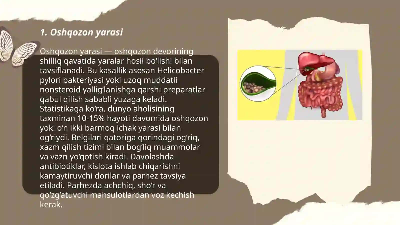 Oshqozon yarasi 3