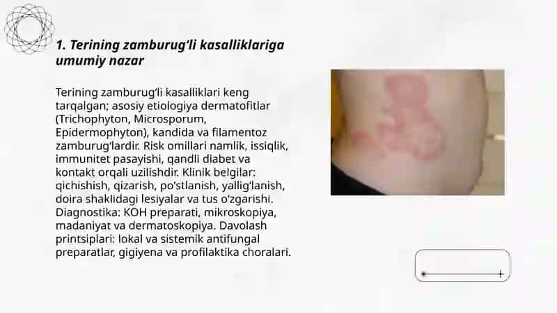 Terining zamburugʻli kasaliklari 3