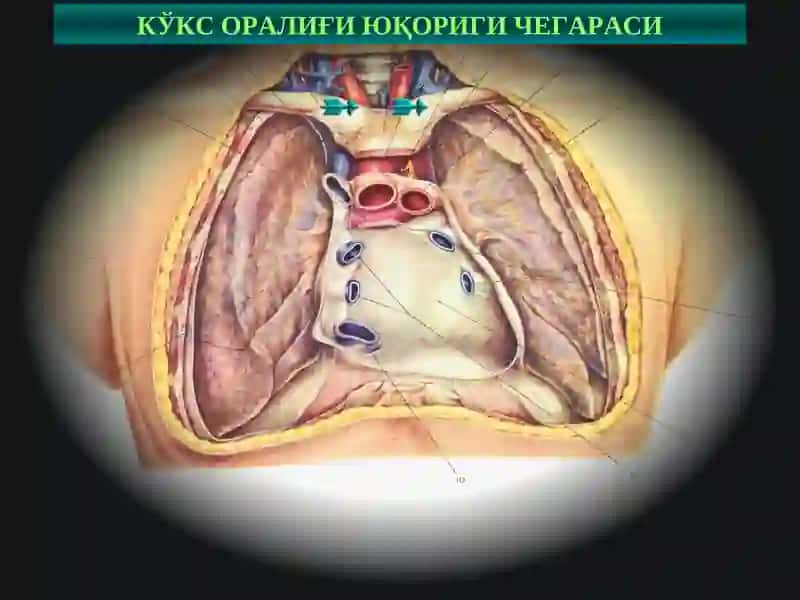 Кўкс оралиғи ва диафрагма касалликлари 3