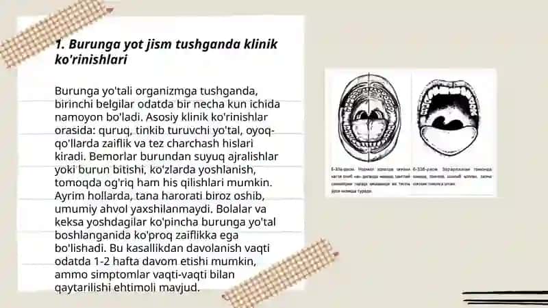 Burunga yot jism tushganda klinikasi,etiologiyasi, Differensial tashxis,va davolash 3