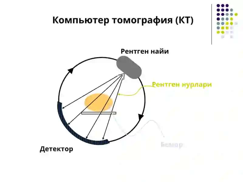 Компютер томография тарихи 3