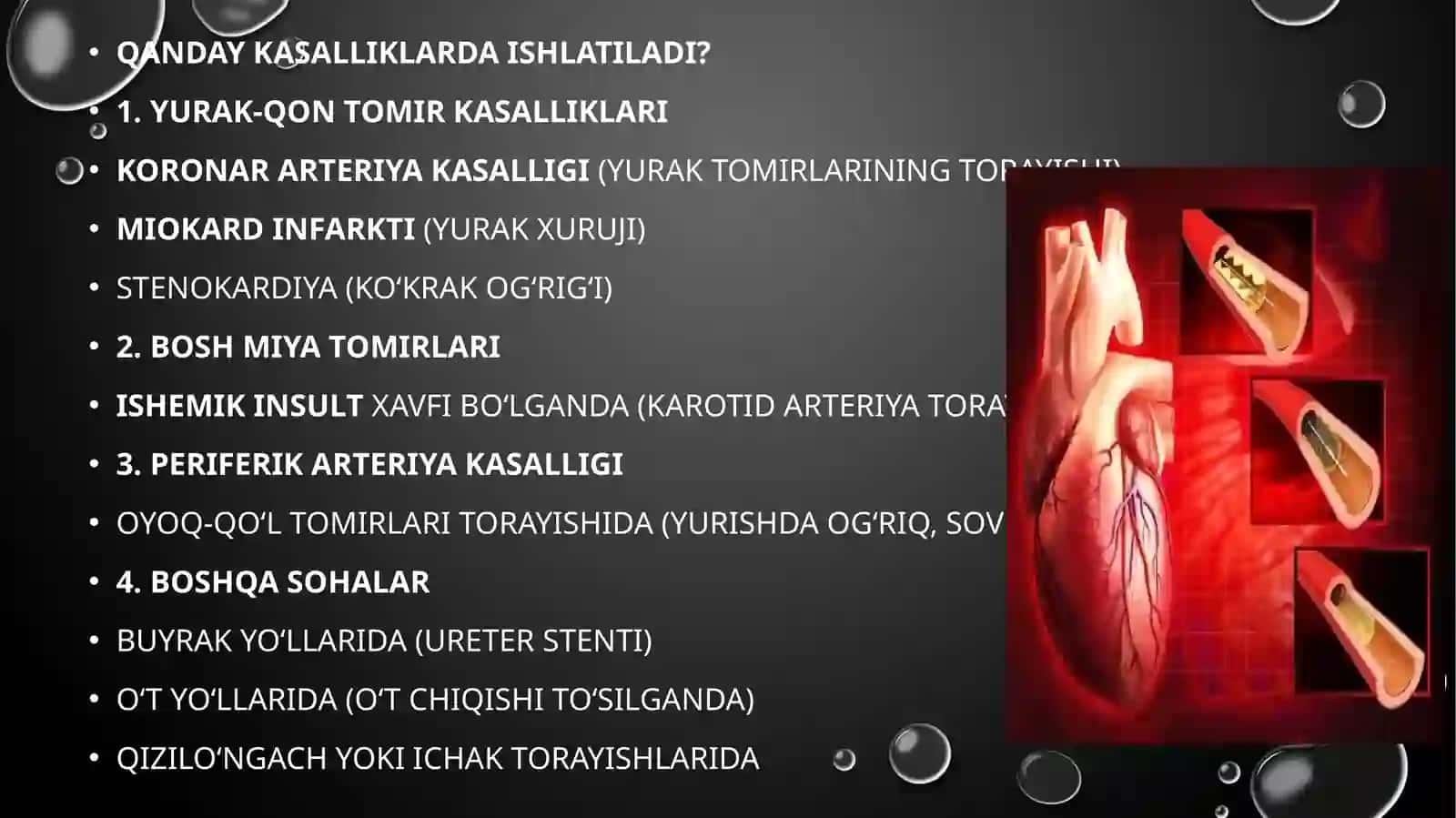 Stentlar haqida umumiy ma’lumot 3