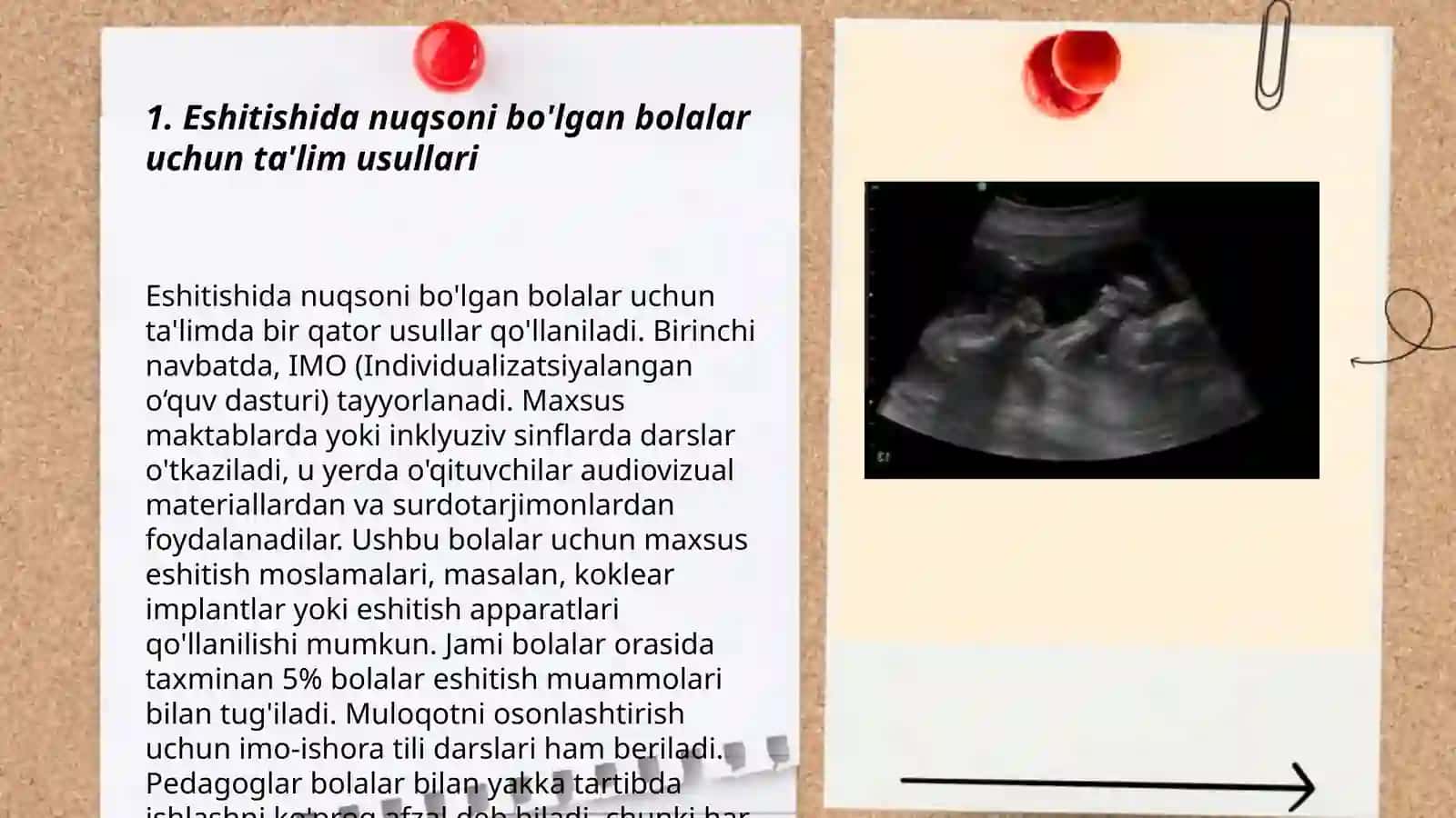 Eshitishida nuqsoni bo'lgan bolalar 3